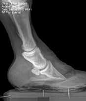 Lasodo_Feb_20_2013_RF_lateral_before_xray.jpg (35449 bytes)